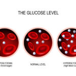 Diabetes Mellitus