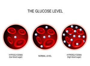 Diabetes Mellitus